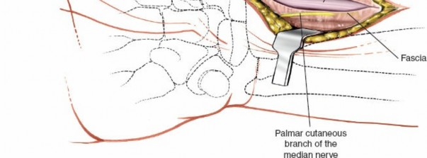 Illustration 54 for Essential Surgical Approaches: Uncover Every Aspect of the Wrist