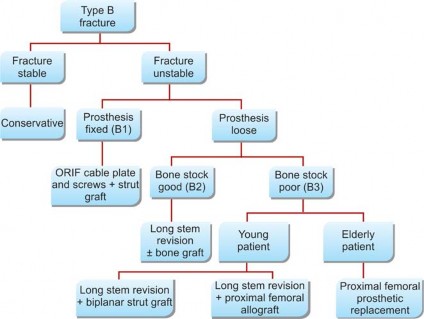 Illustration 21 for Mastering Fractures After Total Hip Arthroplasty