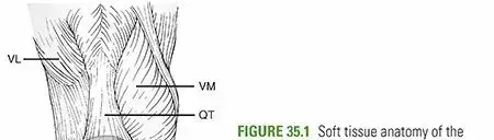 صورة توضيحية لـ إصابات الرضفة والجهاز الباسط للركبة: دليلك الشامل لاستعادة الحركة في اليمن والخليج