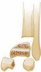 Illustration 43 for Pediatric Ankle Fractures: Management to Prevent Long-Term Issues