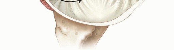 Illustration 23 for Regain Stability: Arthroscopy for Anterior Instability & the Inferior Glenohumeral Ligament