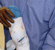 Illustration 53 for Unlock the Figure Posterior Approach to the Hip