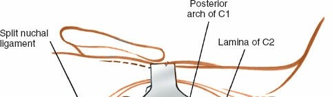 Illustration 228 for Approach to the Lumbar Spine: Mastering Techniques & Anatomy