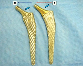 صورة توضيحية لـ إتقان توازن الأنسجة الرخوة لمفصل ورك صناعي مثالي: دليل شامل للمرضى مع الأستاذ الدكتور محمد هطيف