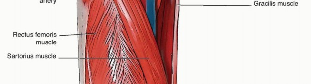 Illustration 8 for Total Hip Arthroplasty: Journey to Preventing Complications