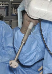 Illustration 37 for Robotics in Total Hip Arthroplasty: A New Era of Precision