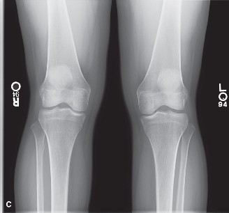 Illustration 2 for Solve Sports Medicine Cases: Diagnose & Treat Real Injuries