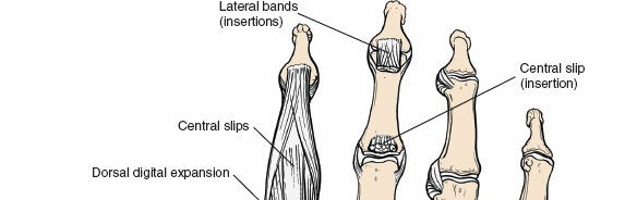 Illustration 39 for Dorsal Wrist Approach: Expert Access to the Column of the Distal Radius