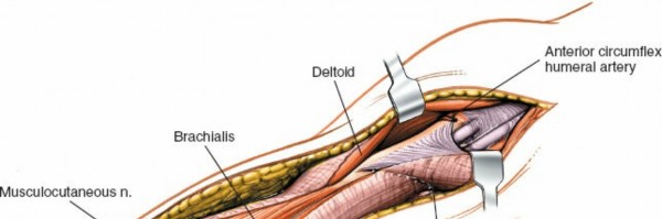 Illustration 12 for Mastering the Approach to the Distal Humerus: Safety & Skills