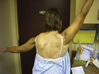 Illustration 36 for Right Shoulder Pain? Avoid This Common X-ray Mistake.