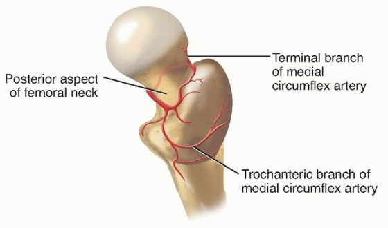 Femoral Head Fixation: Crucial Details for Effective Treatment