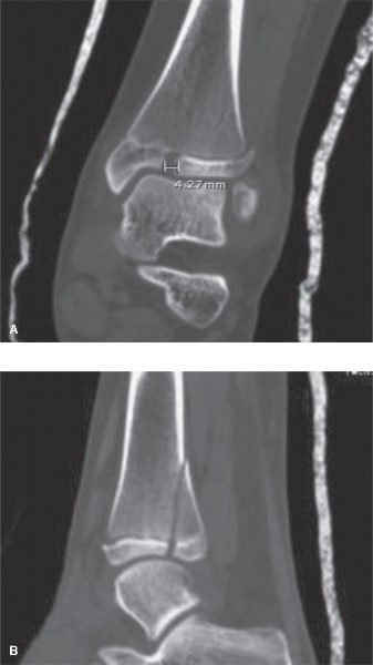 Illustration 6 for 9 Pediatrics Cases: Essential Insights on Rotation of the Foot