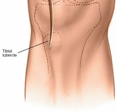 Illustration 31 for Mastering Knee Approaches: Spotlight on Superficial Medial Ligament