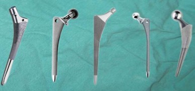 Illustration 42 for Mastering Hip Arthroplasty: Its Evolution and Design Unveiled