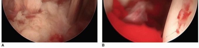 Illustration 9 for Hip Pain Relief: Arthroscopy for Nonstructural Pathology