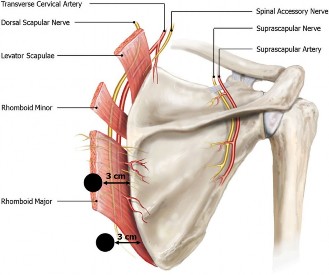 Illustration 57 for Right Shoulder Pain? Avoid This Common X-ray Mistake.