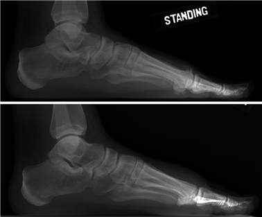 Illustration 55 for First Metatarsal Surgery: Expert Solutions for Foot & Ankle Pain