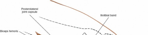 Illustration 152 for Mastering Knee Approaches: Spotlight on Superficial Medial Ligament