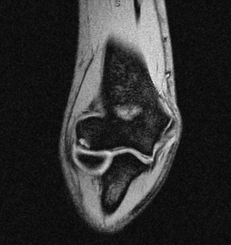 Illustration 94 for Right Shoulder Pain? Avoid This Common X-ray Mistake.