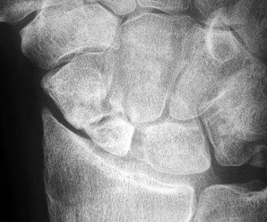 صورة طبية: دليل الأستاذ الدكتور محمد هطيف الشامل لأمراض وإصابات اليد والمعصم في صنعاء