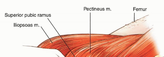 Illustration 28 for Anterior Flap Hemipelvectomy: Leveraging fig tech fig for Difficult Tumors
