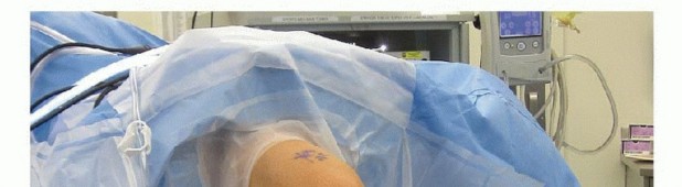 Lateral Retinacular Release: End Patellofemoral Knee Pain