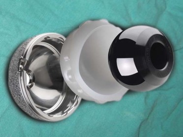 Illustration 98 for Successful Total Hip Replacement in Developmental Dysplasia