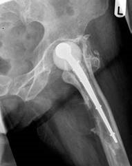 Illustration 4 for Examiner: How Would You Ace Your Hip Viva? Expert Answers