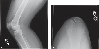 Solve Sports Medicine Cases: Diagnose & Treat Real Injuries
