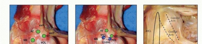 Illustration 4 for Repair & Recover from Collateral Ligament Injuries: Your Guide