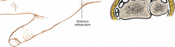 Illustration 10 for Dorsal Wrist Approach: Expert Access to the Column of the Distal Radius