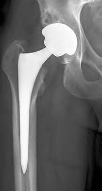 Orthopedic Ob Reconstru Review | Dr Hutaif Hip & Knee R -...