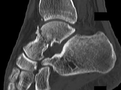 Illustration 120 for OrthoCash: Trauma MCQs & Cases for a yearold woman