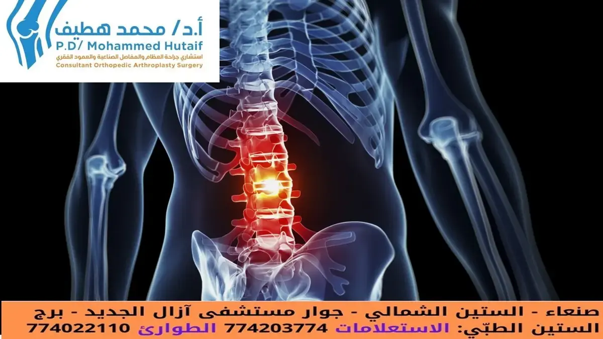 Back Pain Solved: Your Top Questions and Answers on Diagnosis