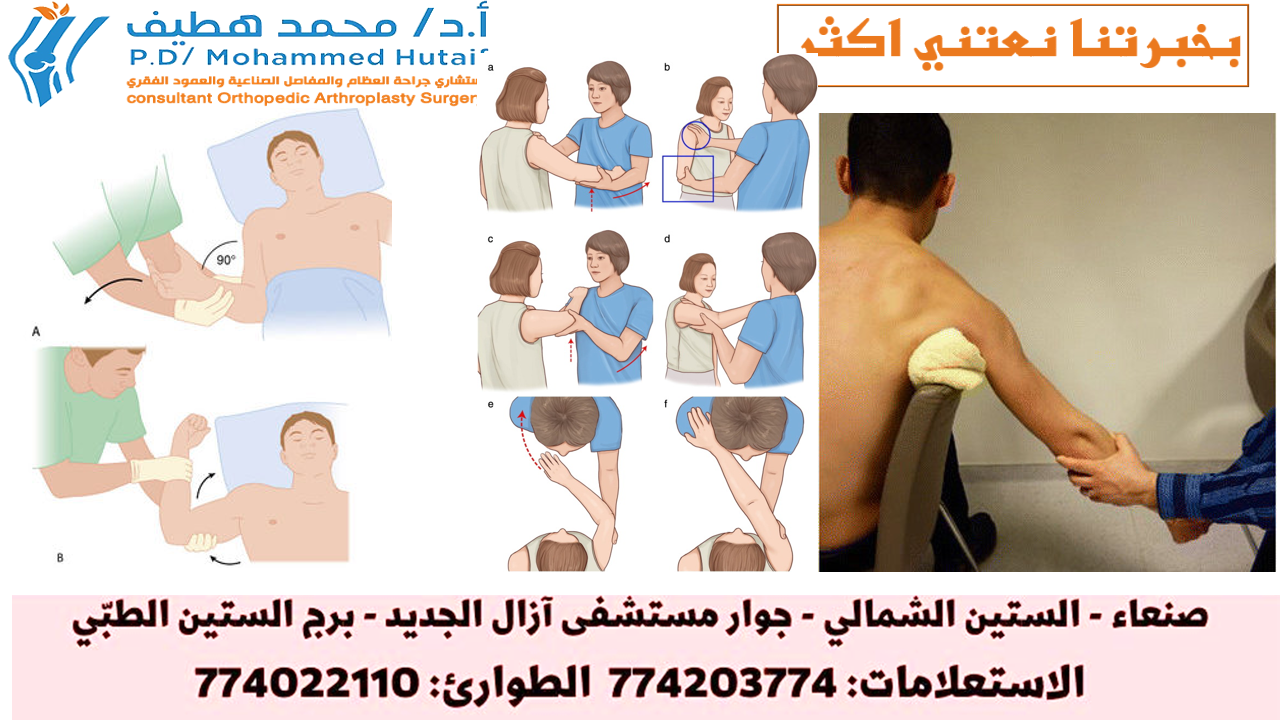 خلع الكتف العلاج: دليل شامل لخطوات التعافي السريع والآمن