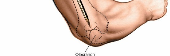 Illustration 35 for Mastering the Approach to the Distal Humerus: Safety & Skills