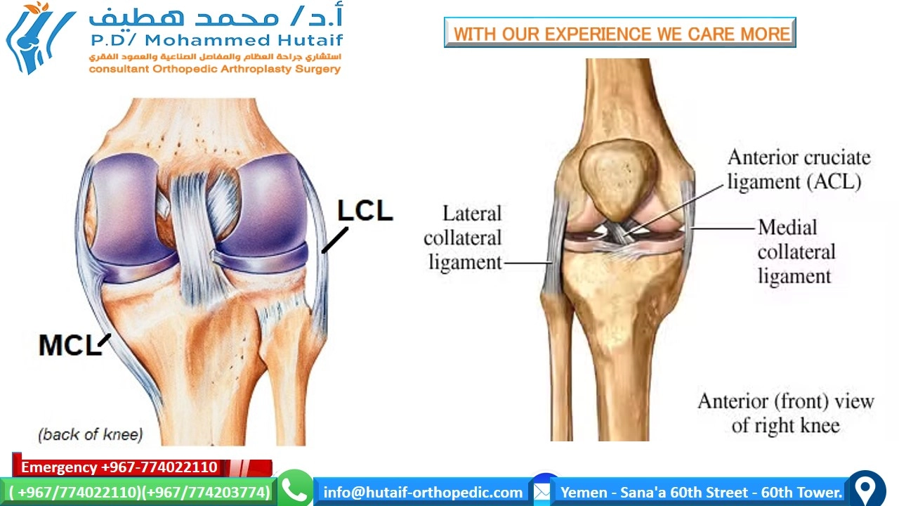 EXCELLENT ORTHOPEDIC DOCTOR YEMEN