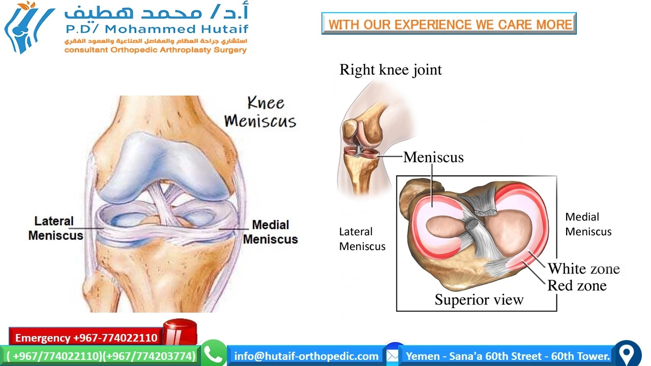 EXCELLENT ORTHOPEDIC DOCTOR YEMEN