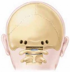 Illustration 9 for Cervical Fusion: The Line is Drawn for Lasting Stability