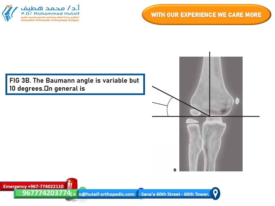 Image describing C-arm positioning for AP and lateral views during elbow surgery.