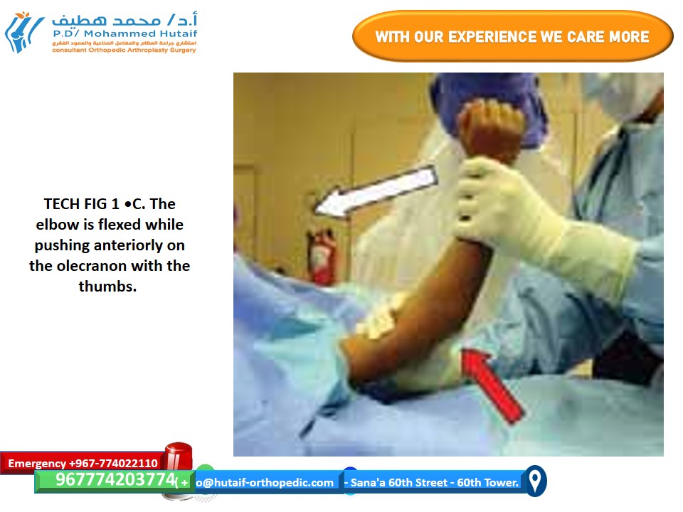  افضل دكتور عظام