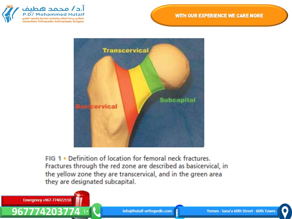 best orthopedic yemen