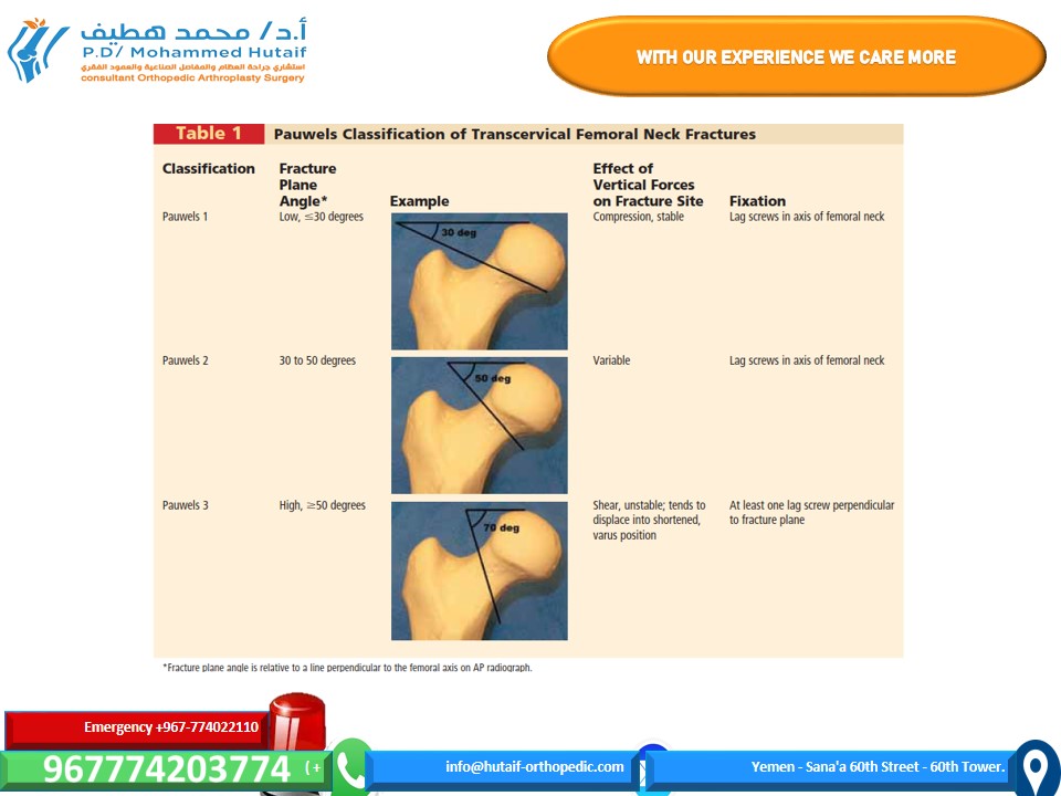 Illustration 1 for Mastering Femoral Neck Fractures: How the Patient Is Positioned