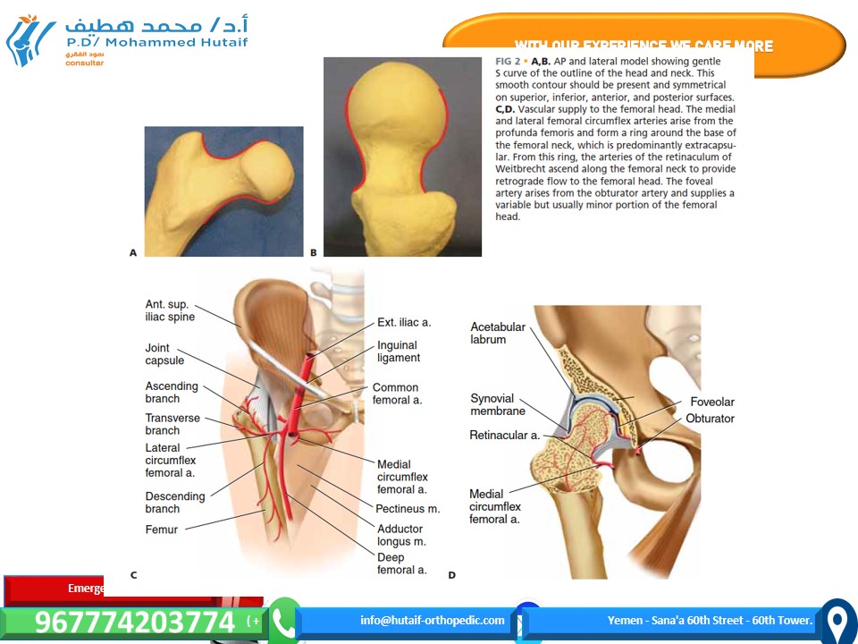 Illustration 2 for Mastering Femoral Neck Fractures: How the Patient Is Positioned