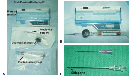 FIG 2 • Stryker intracompartmental pressure monitor. A.  Quick pressure monitoring kit containing the intracompartmental pressure monitor, a prefilled saline syringe, a diaphragm chamber (transducer), and a needle. B. The assembled pressure monitor. To assemble the monitor kit, the needle is attached to the tapered end of the tapered chamber stem (transducer). The blue cap from the prefilled syringe is removed and the syringe is screwed into the remaining end of the transducer, which is a Luer-lock connection. The cover  of the monitor is opened. The transducer is placed inside the well (black  surface down). The snap cover  is closed. Next,  the clear  end cap is pulled off the syringe end, and the monitor is ready to use.  To prime the monitor, the needle is held at 45 degrees up from the horizontal and the syringe plunger is pushed slowly to purge air from the syringe. The monitor is then turned on.  The assembled monitor is tilted at the approximate intended angle of insertion of the needle into the skin. The zero button is pressed to zero the display. The needle is then inserted into the appropriate location in the compartment. C. The intracompartmental pressure monitor needle has side ports to prevent soft  tissue from collapsing around the needle opening.  This is different from a regular needle that has only one opening at the end.