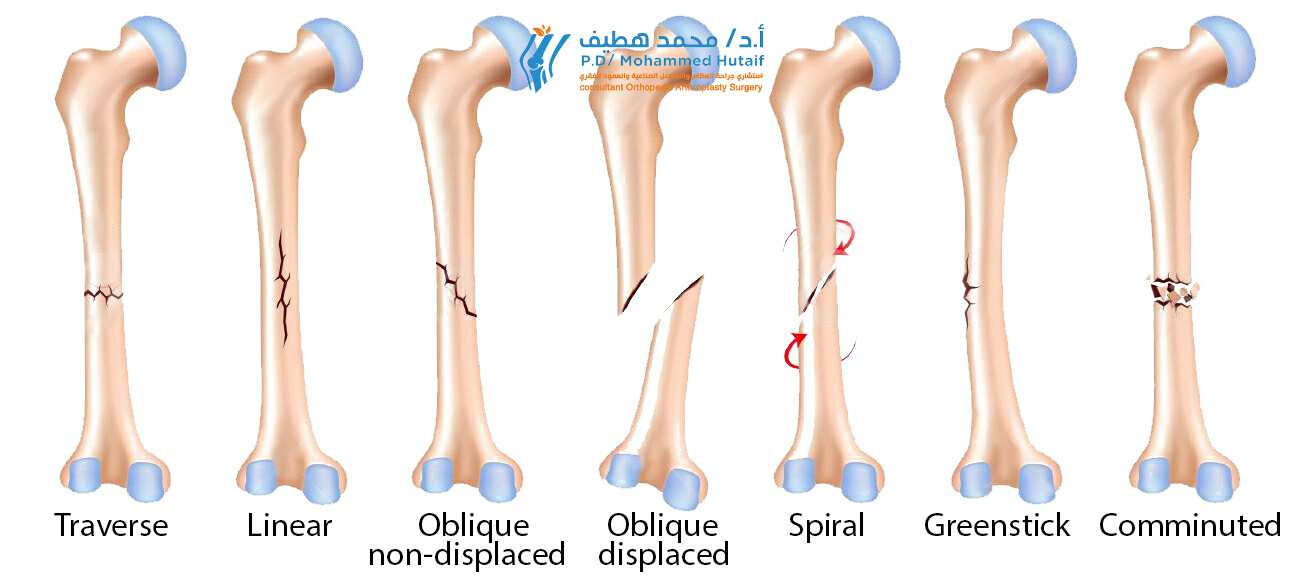Best orthopedic surgeon Yemen