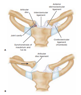 Illustration of sternoclavicular dislocation acute repair - Dr. Mohammed Hutaif
