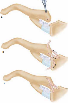 افضل دكتور عظام في اليمن