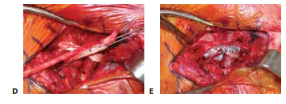 افضل دكتور عظام في اليمن