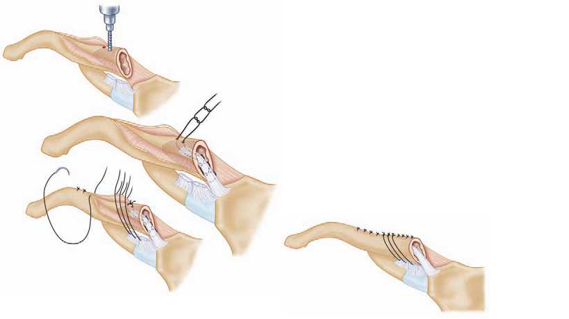 افضل دكتور عظام في اليمن